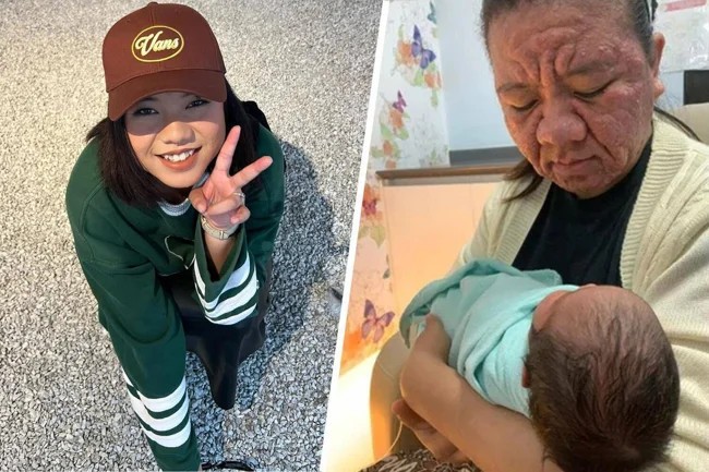 28-летняя девушка из-за беременности постарела до неузнаваемости (3 фото)